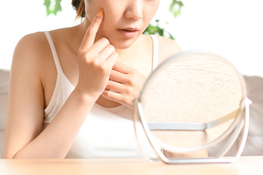 デリヘル勤務中にできる肌荒れ対策